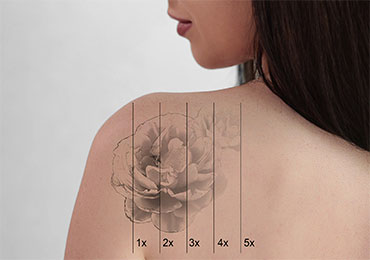 Body toning treatment at Natural Beauty Studio