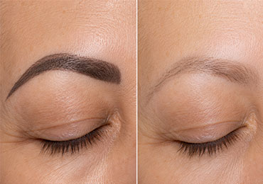 Body toning treatment at Natural Beauty Studio