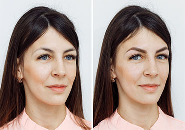 Body toning treatment at Natural Beauty Studio