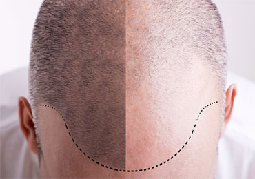 Body toning treatment at Natural Beauty Studio