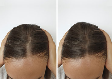 Body toning treatment at Natural Beauty Studio